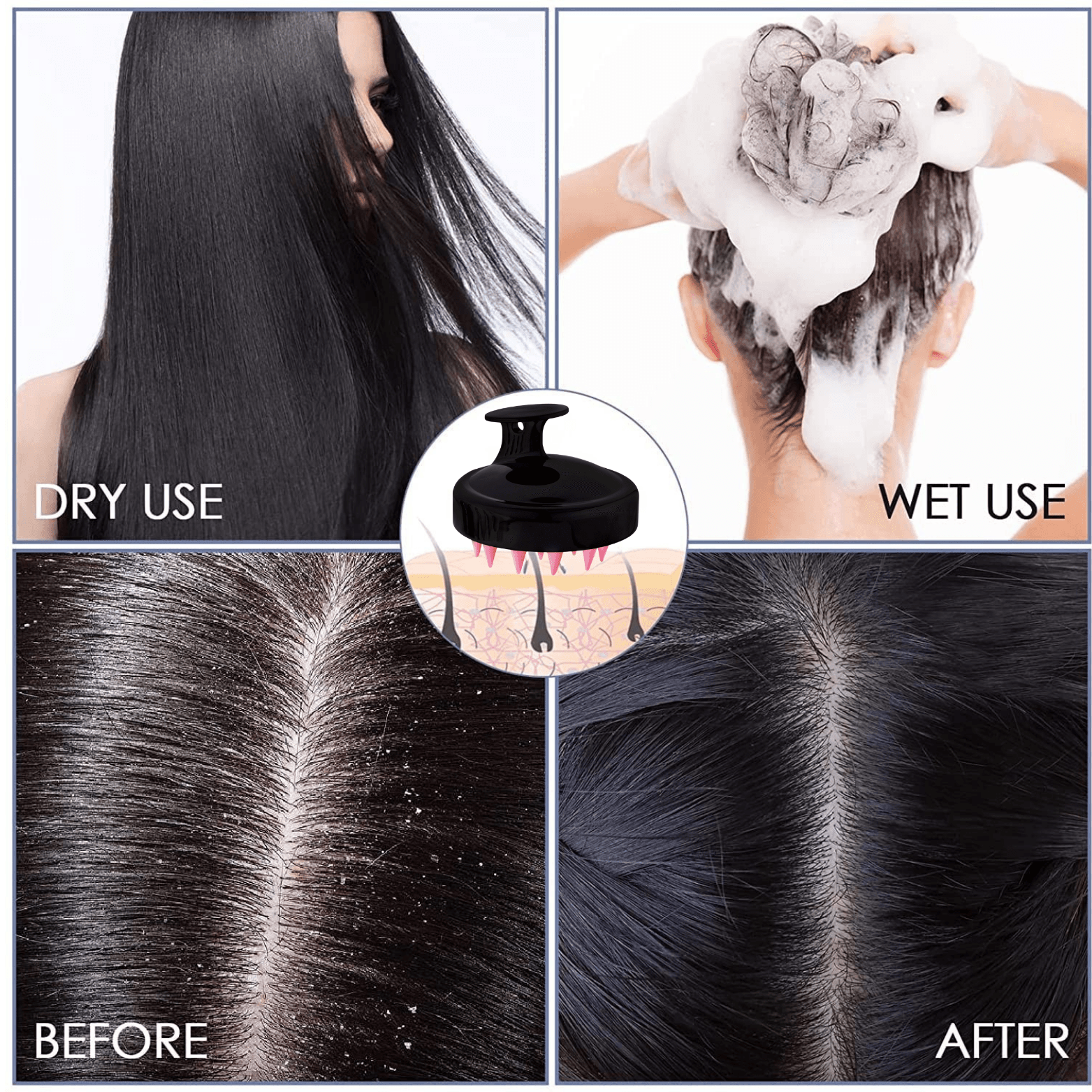 Hair Scalp Scrubber- szczotka do mycia i masażu skóry głowy